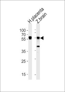 Anti-STK3 Rabbit Polyclonal Antibody