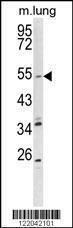 Anti-KvLQT1 Rabbit Polyclonal Antibody (FITC (Fluorescein))