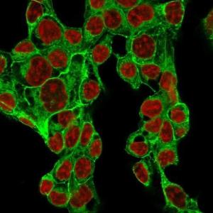 Immunofluorescent analysis of methanol fixed HepG2 cells stained with Anti-Glypican 3 Antibody [GPC3/1534R] followed by Goat Anti-Rabbit IgG (CF&#174; 488) (Green). Nuclear counterstain is RedDot (Red)