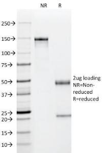 Anti-p53 Mouse Monoclonal Antibody [clone: PAb122]