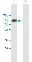 Anti-PKN1 Rabbit Polyclonal Antibody