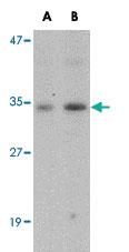 Anti-GNPDA1 Rabbit Polyclonal Antibody