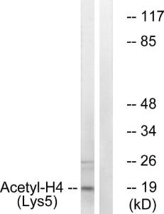 Western blot analysis of lysates from COS7 cells, treated with TSA 400nM 24h using Anti-Histone H4 (acetyl Lys5) Antibody. The right hand lane represents a negative control, where the antibody is blocked by the immunising peptide