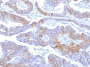 Immunohistochemical analysis of formalin-fixed, paraffin-embedded human colon using Anti-E Cadherin Antibody [SPM381]