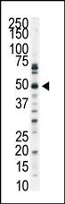 Anti-MAP3K9 Rabbit Polyclonal Antibody