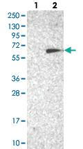 Anti-TC2N Rabbit Polyclonal Antibody