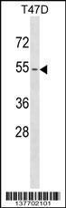 Anti-KRT79 Rabbit Polyclonal Antibody (APC (Allophycocyanin))