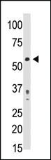 Anti-PDX1 Rabbit Polyclonal Antibody