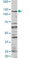 Anti-PKN1 Rabbit Polyclonal Antibody