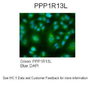 Anti-PPP1R13L Rabbit Polyclonal Antibody