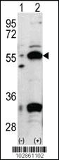 Anti-PDX1 Rabbit Polyclonal Antibody