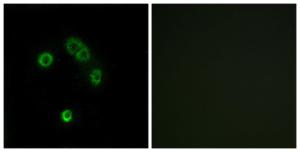 Anti-TAS2R13 antibody