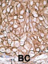 Anti-PDX1 Rabbit Polyclonal Antibody