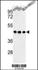 Anti-GPA33 Rabbit Polyclonal Antibody (APC (Allophycocyanin))