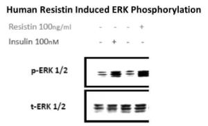 Human recombinant resistin (from <i>E. coli</i>)