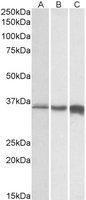 Anti-TNNT3 Goat Polyclonal Antibody (Biotin)