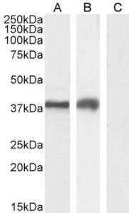 Anti-HAVCR2 Antibody (A84174) (2 µg/ml) staining of Jurkat (A), MOLT4 (B) and negative control A431 (C) cell lysate (35 µg protein in RIPA buffer). Detected by chemiluminescence