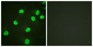 Immunofluorescence analysis of HeLa cells using Anti-Histone H4 (acetyl Lys5) Antibody. The right hand panel represents a negative control, where the antibody was pre-incubated with the immunising peptide