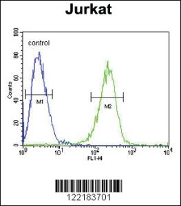 Anti-HADHB Rabbit Polyclonal Antibody