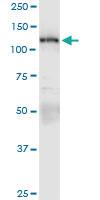 Anti-PKN1 Rabbit Polyclonal Antibody