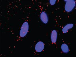 Anti-SMURF1 + GNG11 Antibody Pair