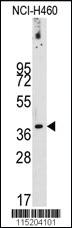 Anti-PDX1 Rabbit Polyclonal Antibody