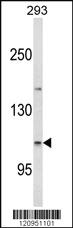 Anti-ESPN Rabbit Polyclonal Antibody