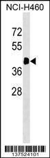 Anti-ACTA1 Rabbit Polyclonal Antibody (Biotin)