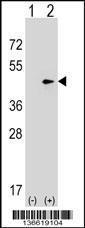 Anti-SEPT2 Rabbit Polyclonal Antibody (FITC (Fluorescein Isothiocyanate))