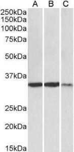 Anti-LDHA Antibody (A82657) (0.3 µg/ml) staining of Heart (A), Skeletal Muscle (B) and Kidney (C) lysates (35 µg protein in RIPA buffer). Primary incubation was 1 hour. Detected by chemiluminescence