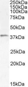 Anti-HAVCR2 Antibody (A84174) (1 µg/ml) staining of Human Tonsil lysate (35 µg protein in RIPA buffer). Detected by chemiluminescence