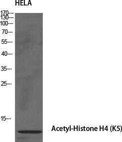 Western blot analysis of various cells using Anti-Histone H4 (acetyl Lys5) Antibody