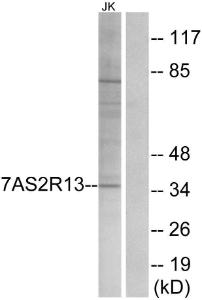 Anti-TAS2R13 antibody