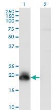 Anti-HAND2 Mouse Monoclonal Antibody [clone: 2C10]