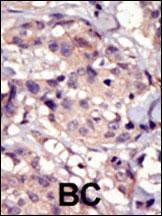 Anti-PDGFRA Rabbit Polyclonal Antibody