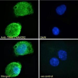 Anti-HAVCR2 Antibody (A84174) - Immunofluorescence analysis of paraformaldehyde fixed HepG2 cells, permeabilized with 0.15% Triton. Primary incubation 1hr (10 µg/ml) followed by Alexa Fluor 488 secondary antibody (2 µg/ml), showing membrane/cytoplasmic and nuclear staining