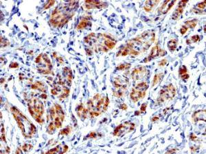 Immunohistochemical analysis of formalin-fixed, paraffin-embedded human uterus using Anti-Caldesmon Antibody [CALD1/1424R]