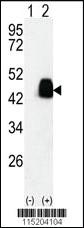 Anti-PDX1 Rabbit Polyclonal Antibody