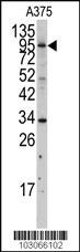 Anti-MYLK Rabbit Polyclonal Antibody