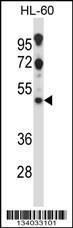 Anti-HTR2C Rabbit Polyclonal Antibody (HRP (Horseradish Peroxidase))