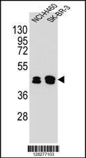 Anti-KRT80 Rabbit Polyclonal Antibody (APC (Allophycocyanin))