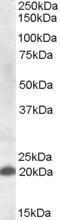 Anti-CLEC4C Antibody (A82658) (1 µg/ml) staining of Human Spleen lysate (35 µg protein in RIPA buffer). Primary incubation was 1 hour. Detected by chemiluminescence