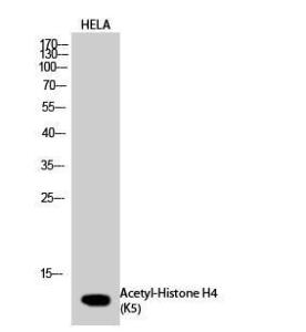 Western blot analysis of HELA cells using Anti-Histone H4 (acetyl Lys5) Antibody