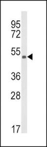 Anti-Kynurenine 3-Monooxygenase Rabbit Polyclonal Antibody (PE (Phycoerythrin))