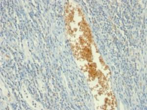 Immunohistochemical analysis of formalin-fixed, paraffin-embedded human tonsil using Anti-AMPD3 Antibody [AMPD3/901]