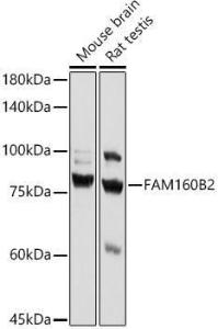 Western blot analysis of extracts of various cell lines, using Anti-Fhip2b Antibody (A305973) at 1:1,000 dilution. The secondary antibody was Goat Anti-Rabbit IgG H&L Antibody (HRP) at 1:10,000 dilution.