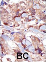 Anti-MYLK Rabbit Polyclonal Antibody