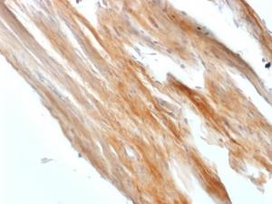 Immunohistochemical analysis of formalin-fixed, paraffin-embedded rat uterus using Anti-Caldesmon Antibody [CALD1/1424R]