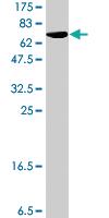 Anti-SPDEF Mouse Polyclonal Antibody