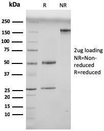 Anti-N Cadherin Mouse Monoclonal Antibody [clone: 13A9]